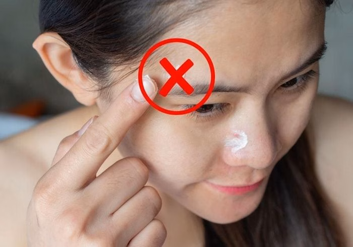 Hiện tượng mốc trắng (white cast) thường xuất hiện rõ rệt ở các dòng kem chống nắng vật lý hạt lớn. Ảnh minh họa.