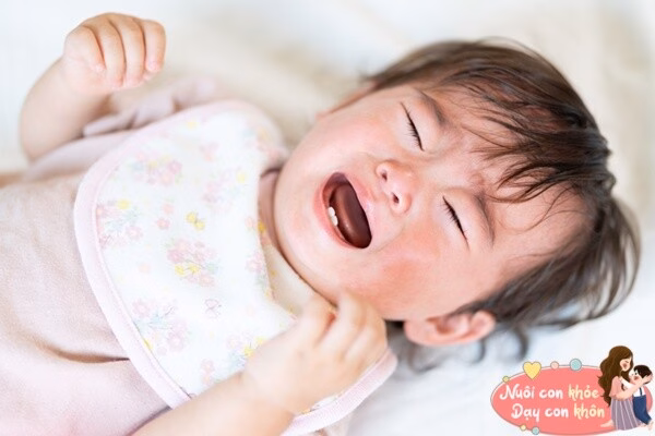 Mồ hôi quá nhiều là nguyên nhân hàng đầu gây rôm sảy ở trẻ nhỏ.